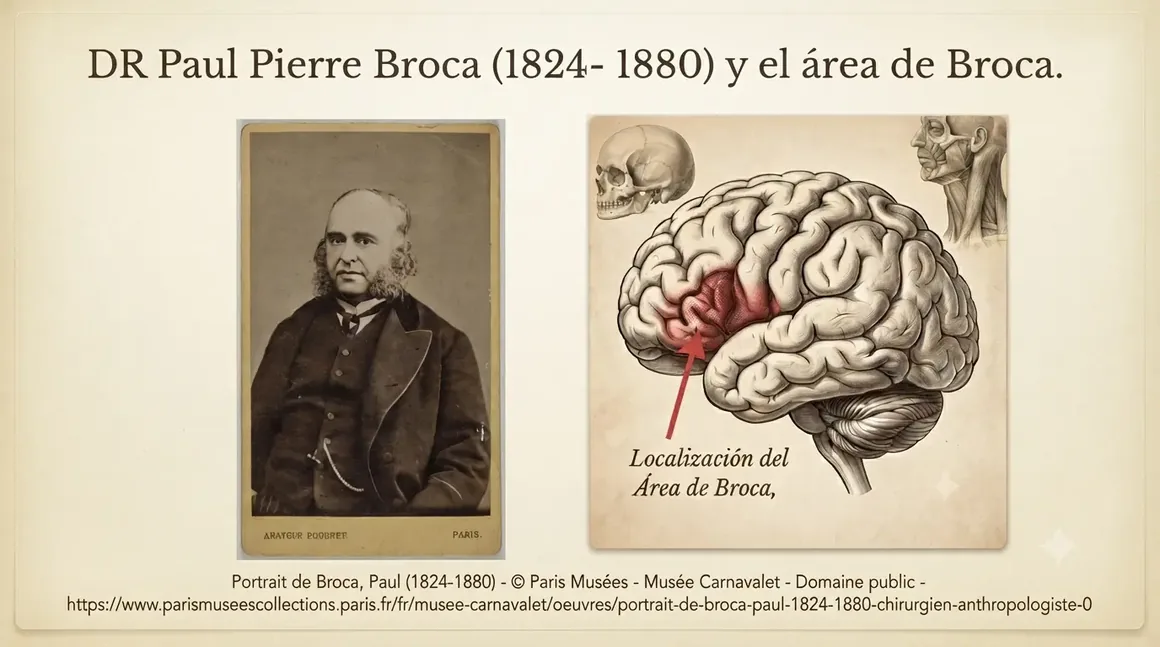 Ilustración histórica del Dr. Paul Broca y la localización anatómica del Área de Broca en el cerebro